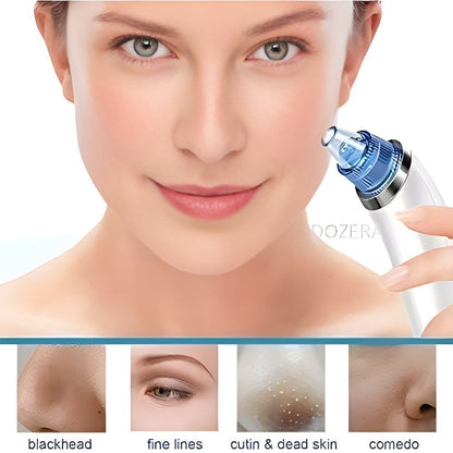 ⭐ Pore Cleaning Device – Deep Clean for Smooth & Clear Skin